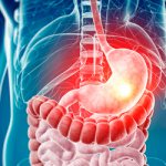 Diseases of the gastrointestinal tract occur - Summer