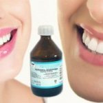 All about teeth whitening with hydrogen peroxide and reviews of the procedure