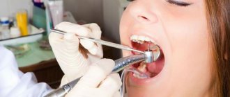 Всегда ли нужна трепанация зуба перед эндодонтическим лечением и что это