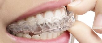 Teeth straightening with aligners